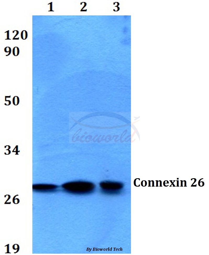 Western blot (WB) analysis of Connexin 26 (H94) pAb at 1:500 dilution Lane1:HEK293T whole cell lysate Lane2:Raw264.7 whole cell lysate Lane3:H9C2 whole cell lysate