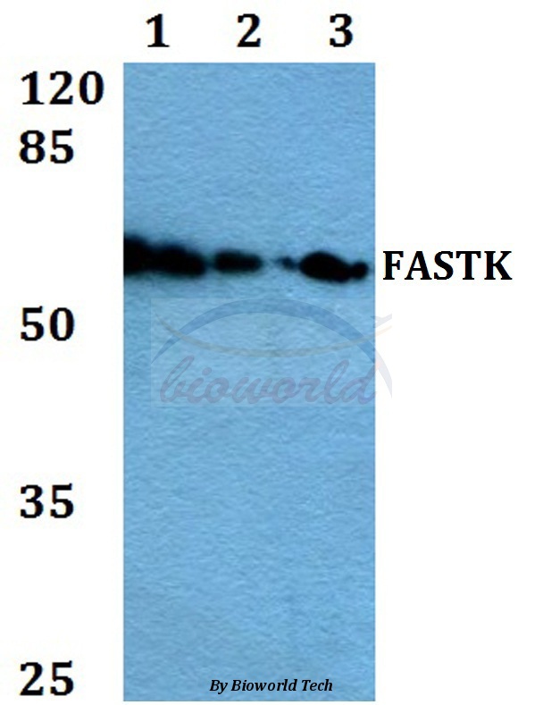 Western blot (WB) analysis of FAST (R410) pAb at 1:500 dilution Lane1:Hela whole cell lysate Lane2:NIH-3T3 whole cell lysate Lane3:PC12 whole cell lysate