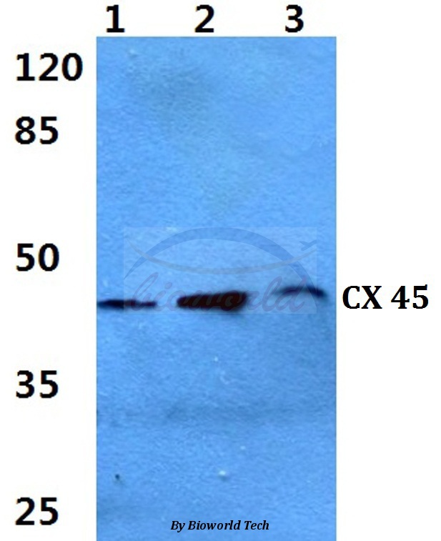 Western blot (WB) analysis of Connexin 45 (N361) pAb at 1:500 dilution Lane1:Hela cell lysate Lane2:sp2/0 cell lysate Lane3:H9C2 cell lysate