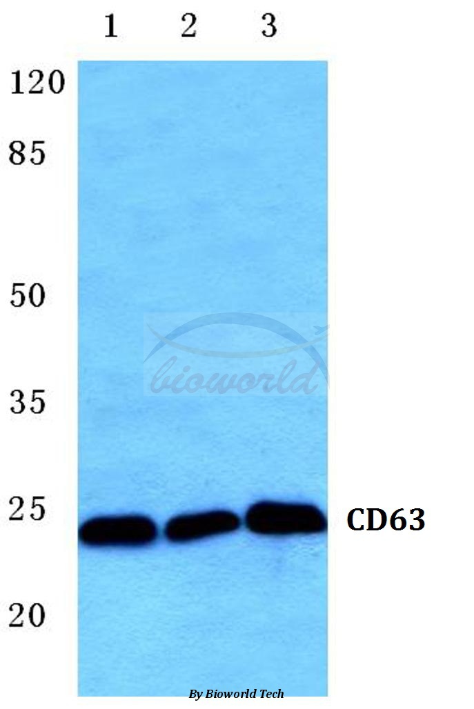 Western blot (WB) analysis of CD63 (K156) pAb at 1:500 dilution Lane1:HEK293T cell lysate Lane2:Raw264.7 cell lysate Lane3:H9C2 cell lysate