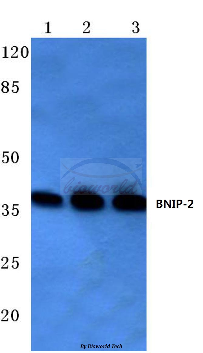 Western blot (WB) analysis of BNIP-2 (E122) pAb at 1:500 dilution Lane1:HEK293T cell lysate Lane2:Mouse liver tissue lysate Lane3:Rat liver tissue lysate