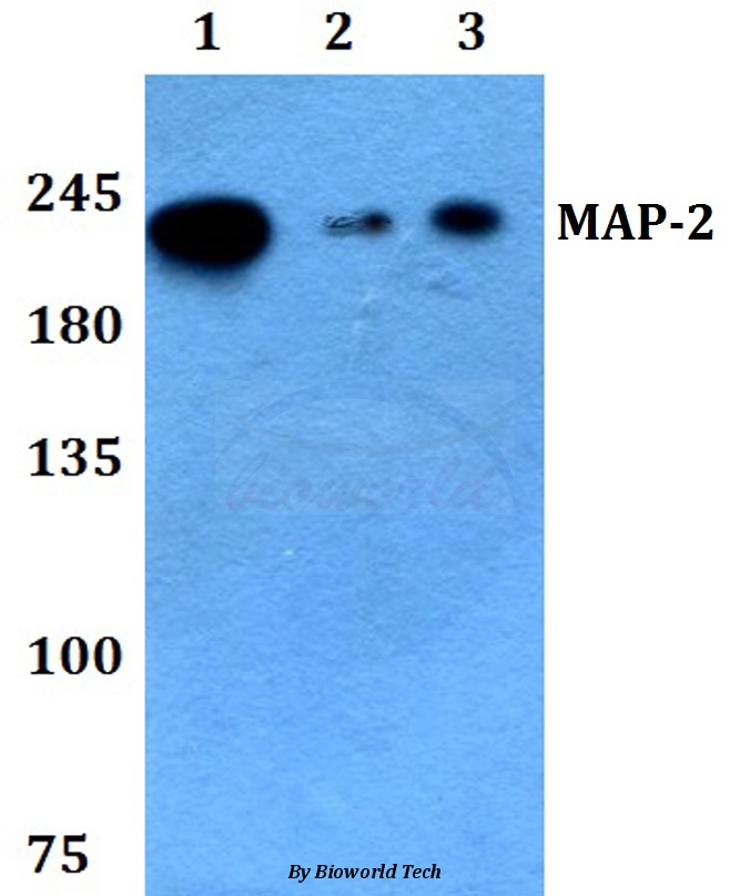 Western blot (WB) analysis of MAP-2 (W14) pAb at 1:500 dilution Lane1:HEK293T whole cell lysate Lane2:Raw264.7 whole cell lysate Lane3:PC12 whole cell lysate