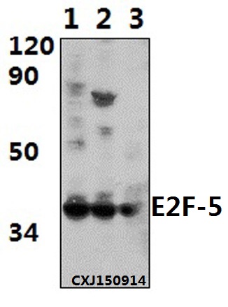 Western blot (WB) analysis of E2F-5 (L142) pAb at 1:500 dilution Lane1:HepG2 whole cell lysate(40ug) Lane2:NIH-3T3 whole cell lysate(40ug) Lane3:H9C2 whole cell lysate(40ug)
