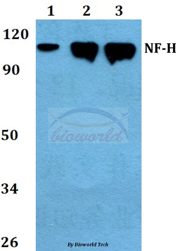Western blot (WB) analysis of NF-H (E972) pAb at 1:500 dilution Lane1:Hela whole cell lysate Lane2:Raw264.7 whole cell lysate Lane3:PC12 whole cell lysate