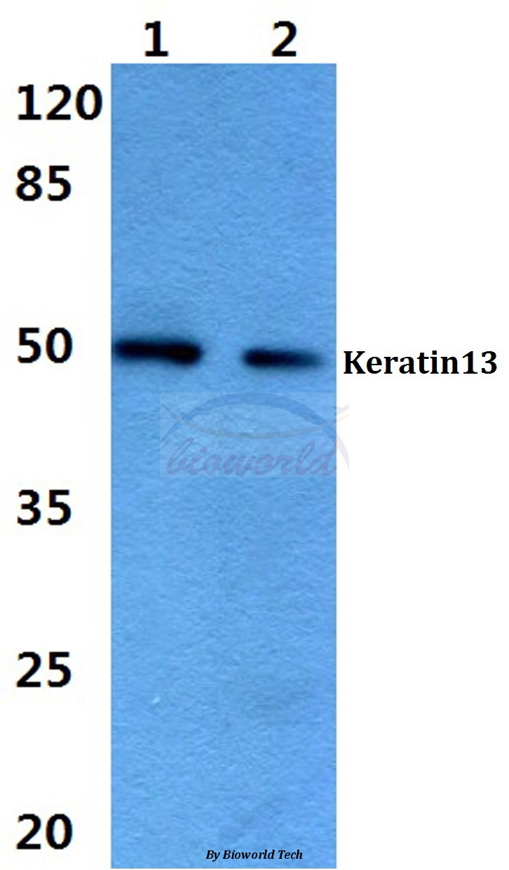 Western blot (WB) analysis of Cytokeratin 13 (E282) pAb at 1:500 dilution Lane1:A549 cell lysate Lane2:H9C2 cell lysate