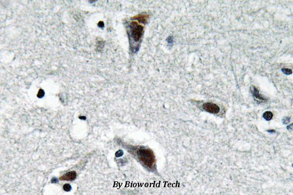 Immunohistochemistry (IHC) analyzes of RFC3 (L227) pAb in paraffin-embedded human brain tissue.