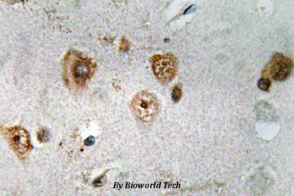 Immunohistochemistry (IHC) analyzes of NCoA-3 (S587) pAb in paraffin-embedded human brain tissue.