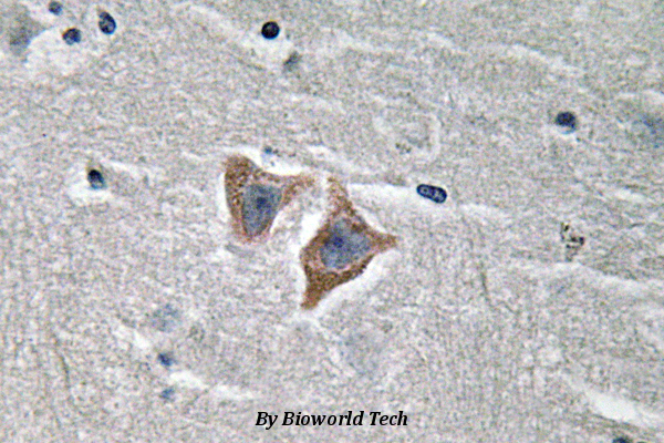 Immunohistochemistry (IHC) analyzes of CD57 (V35) pAb in paraffin-embedded human brain tissue.