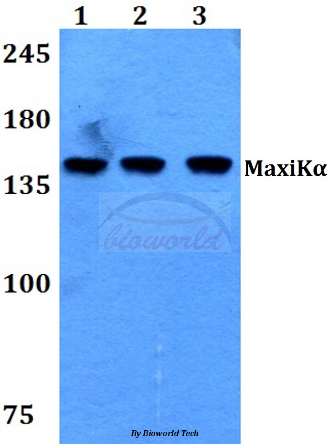 Western blot (WB) analysis of MaxiKα (Q770) pAb at 1:500 dilution Lane1:HEK293T whole cell lysate Lane2:Raw264.7 whole cell lysate Lane3:H9C2 whole cell lysate