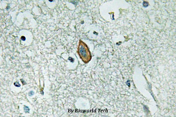 Immunohistochemistry (IHC) analyzes of MaxiKα (Q770) pAb in paraffin-embedded human brain tissue.
