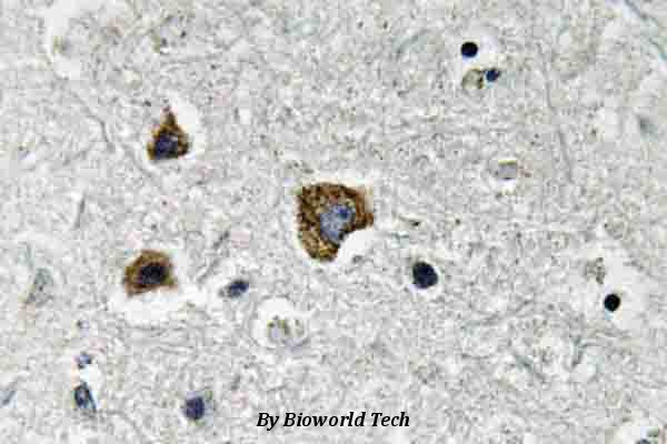 Immunohistochemistry (IHC) analyzes of BNIP-3 (E96) pAb in paraffin-embedded human brain tissue.
