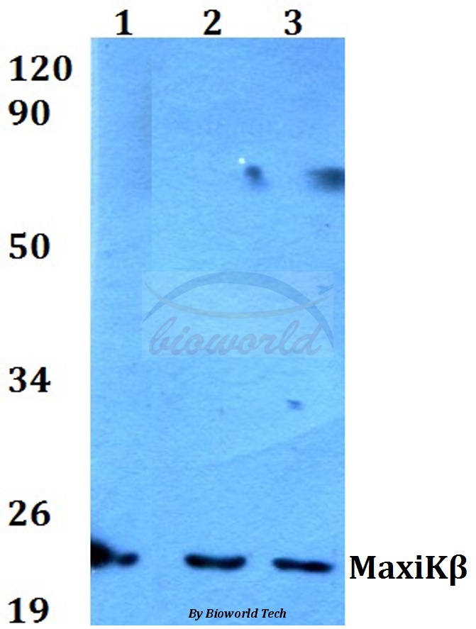 Western blot (WB) analysis of MaxiKβ (K119) pAb at 1:500 dilution Lane1:HEK293T whole cell lysate Lane2:Rat brain tissue lysate Lane3:PC12 whole cell lysate