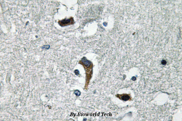 Immunohistochemistry (IHC) analyzes of MaxiKβ (K119) pAb in paraffin-embedded human brain tissue.