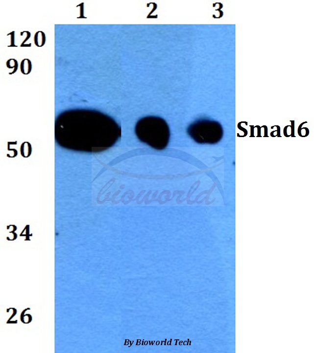 Western blot (WB) analysis of Smad6 (N372) pAb at 1:500 dilution Lane1:HEK293T whole cell lysate Lane2:Raw264.7 whole cell lysate Lane3:PC12 whole cell lysate
