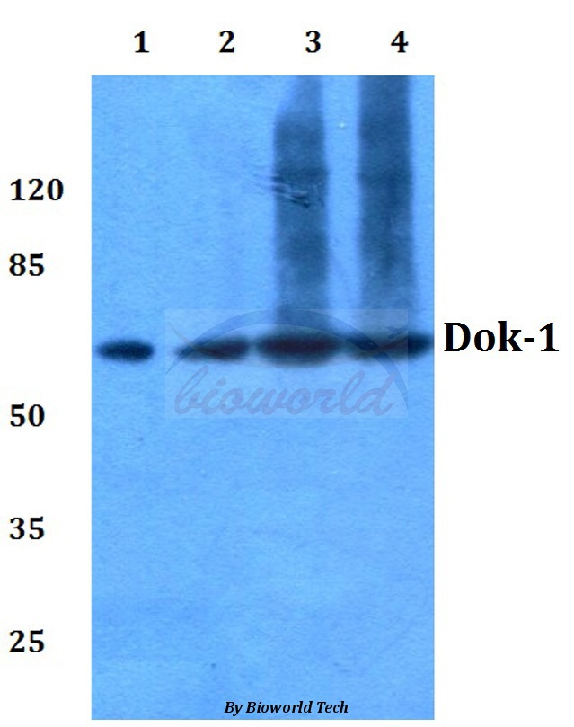 Western blot (WB) analysis of Dok-1 (R392) pAb at 1:500 dilution Lane1:HEK293T whole cell lysate Lane2:Hela whole cell lysate Lane3:sp2/0 whole cell lysate Lane4:PC12 whole cell lysate