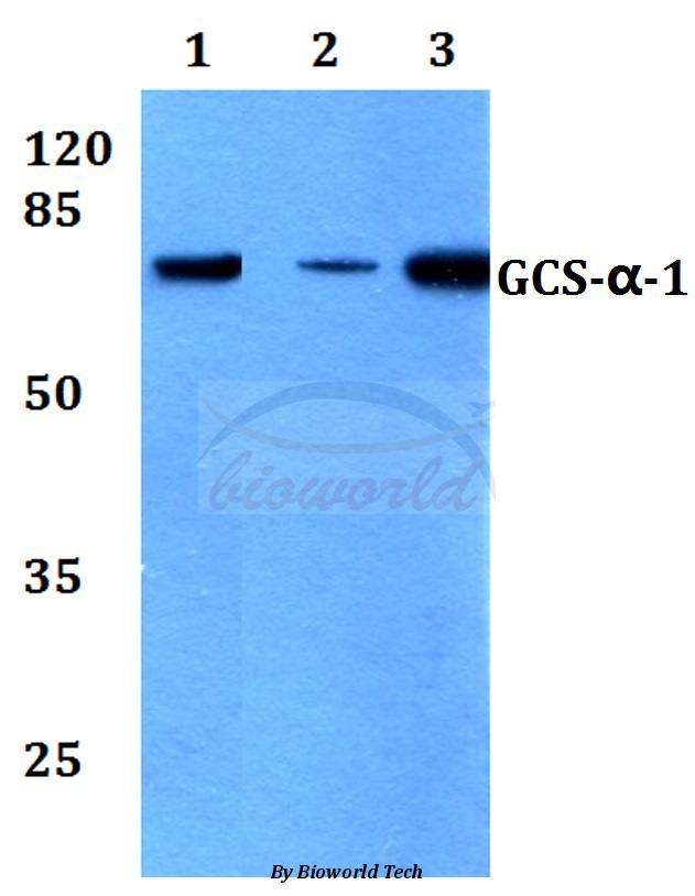 Western blot (WB) analysis of GCS-α-1 (D423) pAb at 1:500 dilution Lane1:HEK293T whole cell lysate Lane2:sp2/0 whole cell lysate Lane3:H9C2 whole cell lysate