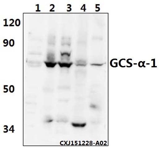 Western blot (WB) analysis of GCS-α-1 (D423) pAb at 1:500 dilution Lane1:A549 whole cell lysate(40ug) Lane2:The brain tissue lysate of Mouse(30ug) Lane3:The brain tissue lysate of Rat(30ug) Lane4:The lung tissue lysate of Mouse(30ug) Lane5:The lung tissue