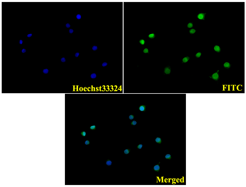 IF image of BS3689 stained A549 cells.The cells were 4% paraformaldehyde fixed (20 min) and then incubated in 10% normal goat serum for 1h to permeabilise the cells and block non-specific protein-protein interactions. The cells were then incubated with