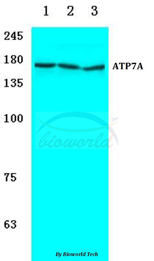 Western blot (WB) analysis of ATP7A (H640) pAb at 1:500 dilution Lane1:Hela cell lysate Lane2:NIH-3T3 cell lysate Lane3:Rat brain tissue lysate