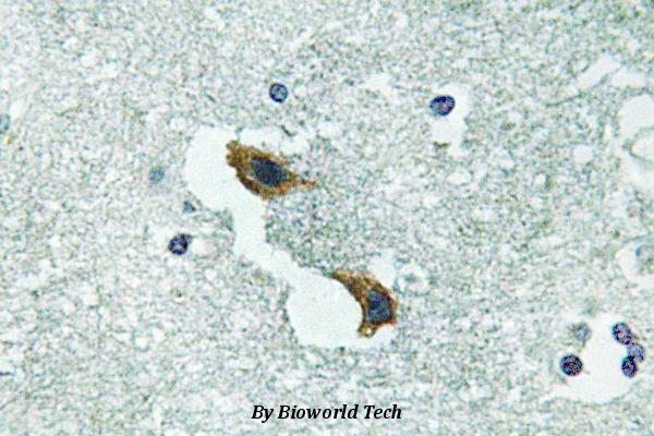 Immunohistochemistry (IHC) analyzes of ATP7A (H640) pAb in paraffin-embedded human brain tissue.