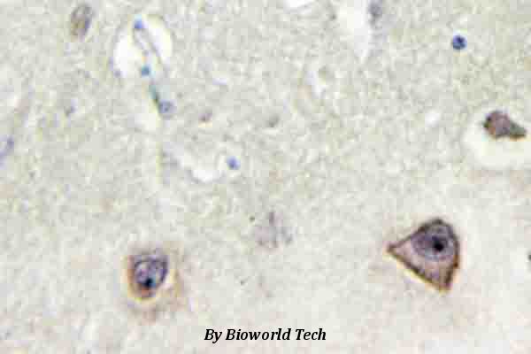 Immunohistochemistry (IHC) analyzes of NMDAζ1 (F891) pAb in paraffin-embedded human brain tissue.