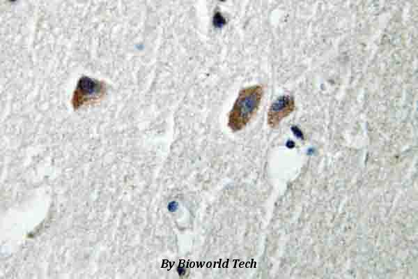 Immunohistochemistry (IHC) analyzes of CaMKIIβ/γ/δ (S280) pAb in paraffin-embedded human brain tissue.