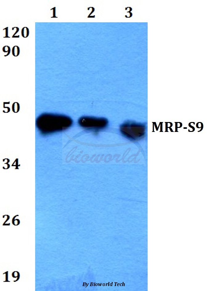 Western blot (WB) analysis of MRP-S9 (F132) pAb at 1:500 dilution Lane1:HEK293T whole cell lysate Lane2:Raw264.7 whole cell lysate Lane3:H9C2 whole cell lysate