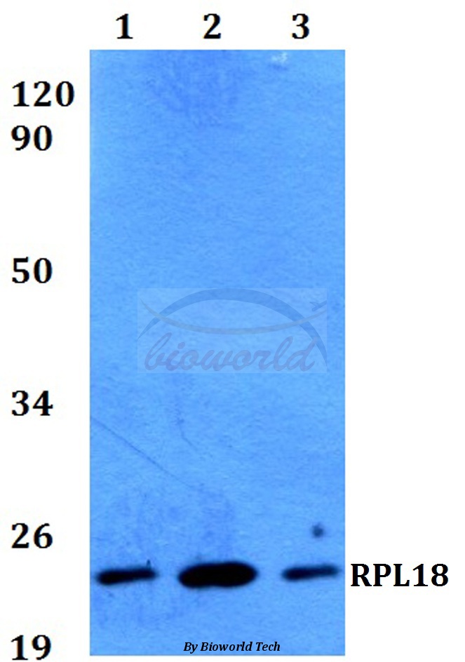 Western blot (WB) analysis of RPL18 (H151) pAb at 1:500 dilution Lane1:HEK293T whole cell lysate Lane2:Raw264.7 whole cell lysate Lane3:H9C2 whole cell lysate