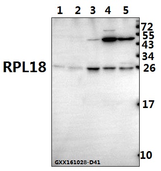 Western blot (WB) analysis of RPL18 (H151) pAb at 1:500 dilution Lane1:The Heart tissue lysate of Mouse(40ug) Lane2:The Heart tissue lysate of Rat(40ug) Lane3:HEK293T whole cell lysate(40ug) Lane4:HCC827 whole cell lysate(40ug) Lane5:L02 whole cell lysate