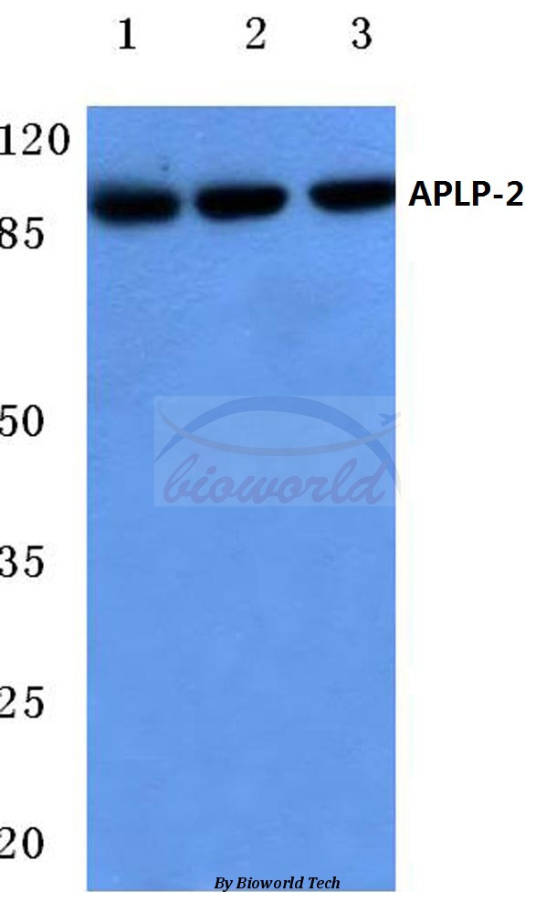Western blot (WB) analysis of APLP-2 (Y274) pAb at 1:500 dilution Lane1:A549 cell lysate Lane2:Mouse heart tissue lysate Lane3:Rat heart tissue lysate