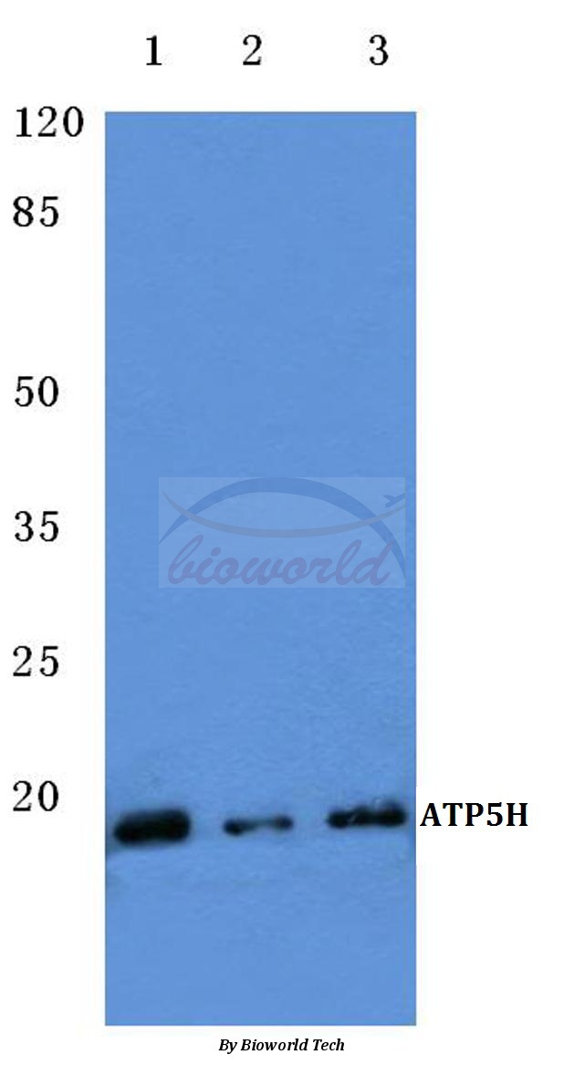Western blot (WB) analysis of ATP5H (D146) pAb at 1:500 dilution Lane1:HEK293T cell lysate Lane2:Mouse brain tissue lysate Lane3:H9C2 cell lysate
