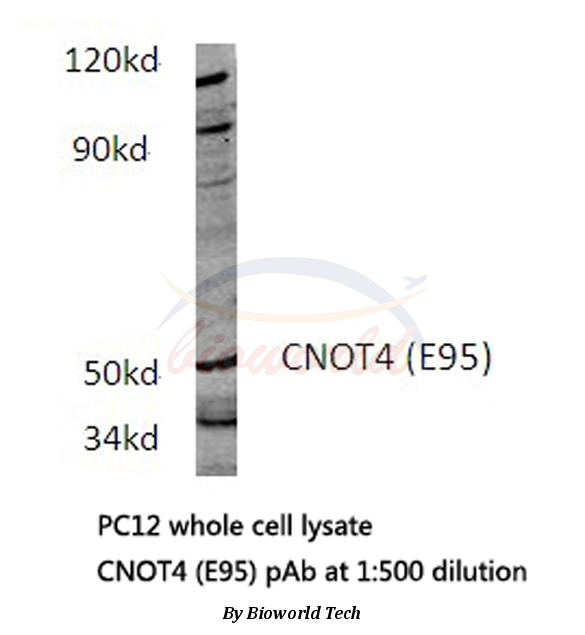 Western blot (WB) analysis of CNOT4 (E95) pAb in extracts from PC12 cells.