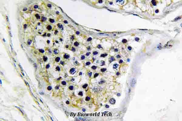 Immunohistochemistry (IHC) analyzes of CNOT4 (E95) pAb in paraffin-embedded human testis tissue.