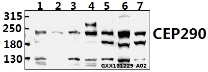 Western blot (WB) analysis of CEP290 (F812) pAb at 1:500 dilution Lane1:HCT116 whole cell lysate(40ug) Lane2:SGC7901 whole cell lysate(40ug) Lane3:COS-7 whole cell lysate(40ug) Lane4:A549 whole cell lysate(40ug) Lane5:CT26 whole cell lysate(40ug) Lane6:AML-12 whole cell lysate(40ug) Lane7:PC12 whole cell lysate(40ug)