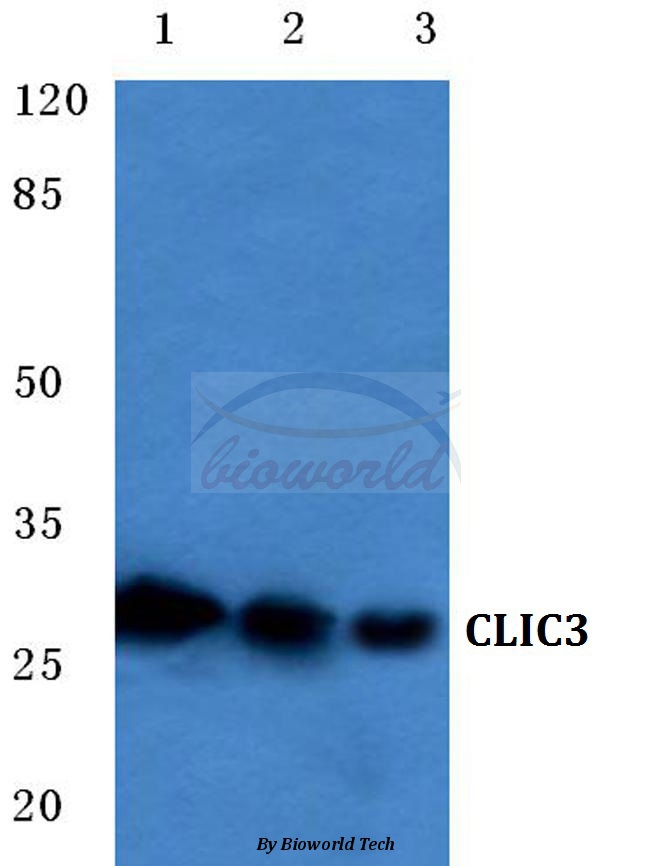 Western blot (WB) analysis of CLIC3 (F56) pAb at 1:500 dilution Lane1:HEK293T cell lysate Lane2:Mouse liver tissue lysate Lane3:Rat kidney tissue lysate