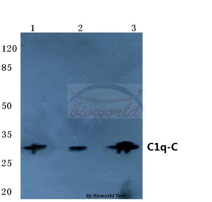 Western blot (WB) analysis of C1q-C (Q119) pAb at 1:500 dilution Lane1:HepG2 cell lysate Lane2:sp2/0 cell lysate Lane3:Rat kidney tissue lysate
