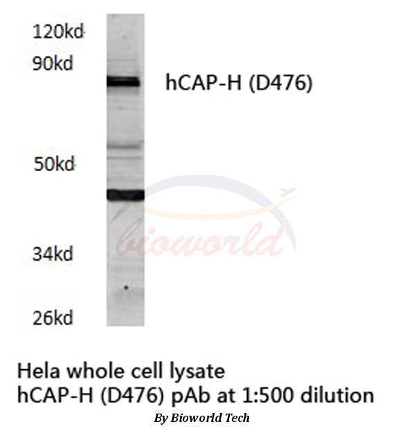 Western blot (WB) analysis of hCAP-H (D476) pAb in extracts from HELA cells.