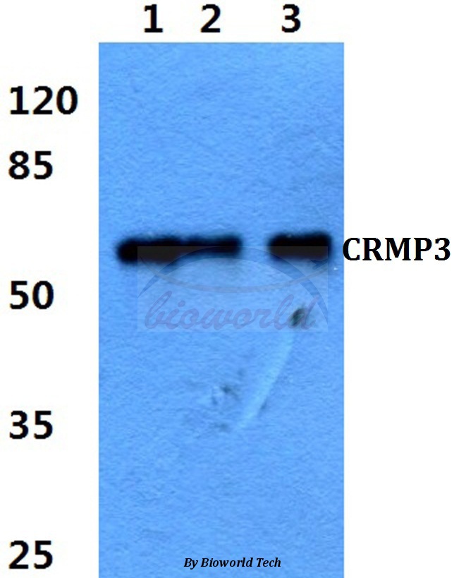 Western blot (WB) analysis of CRMP-3 (C132) pAb at 1:500 dilution Lane1:Jurkat cell lysate Lane2:sp2/0 cell lysate Lane3:PC12 cell lysate