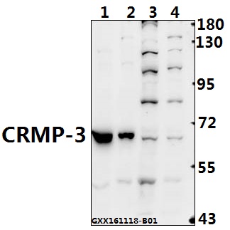 Western blot (WB) analysis of CRMP-3 (C132) pAb at 1:500 dilution Lane1:The Heart tissue lysate of Rat(40ug) Lane2:The Heart tissue lysate of Mouse(40ug) Lane3:MCF-7 whole cell lysate(40ug) Lane4:SGC7901 whole cell lysate(40ug)