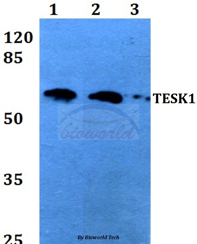 Western blot (WB) analysis of TESK1 (V217) pAb at 1:500 dilution Lane1:HEK293T whole cell lysate Lane2:Raw264.7 whole cell lysate Lane3:H9C2 whole cell lysate