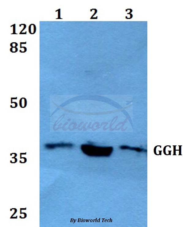 Western blot (WB) analysis of GGH (K287) pAb at 1:500 dilution Lane1:A549 whole cell lysate Lane2:sp2/0 whole cell lysate Lane3:PC12 whole cell lysate