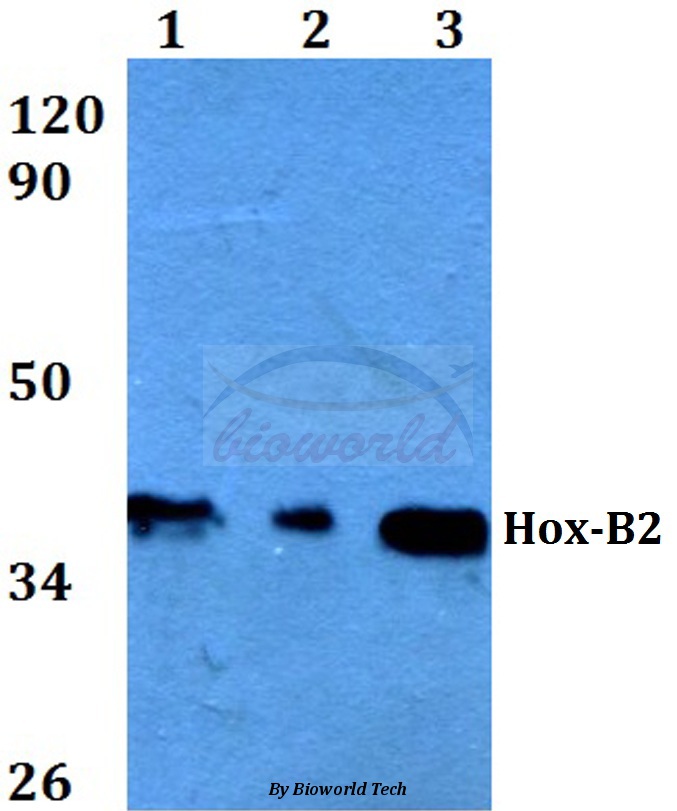 Western blot (WB) analysis of Hox-B2 (P67) pAb at 1:500 dilution Lane1:HEK293T whole cell lysate Lane2:Raw264.7 whole cell lysate Lane3:H9C2 whole cell lysate