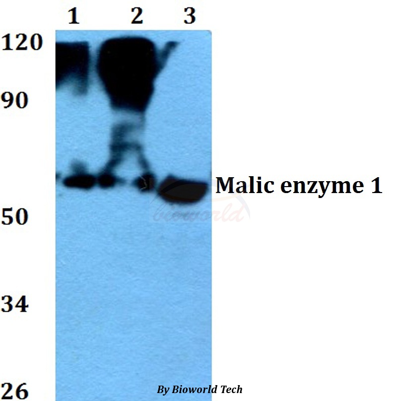 Western blot (WB) analysis of Malic enzyme 1 (Y500) pAb at 1:500 dilution Lane1:HEK293T whole cell lysate Lane2:NIH-3T3 whole cell lysate Lane3:PC12 whole cell lysate