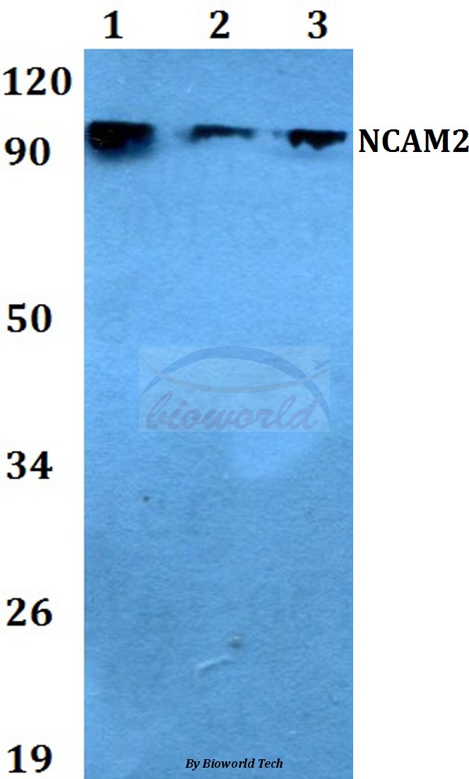 Western blot (WB) analysis of NCAM2 (L296) pAb at 1:500 dilution Lane1:HEK293T whole cell lysate Lane2:Raw264.7 whole cell lysate Lane3:PC12 whole cell lysate