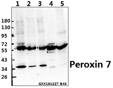 Western blot (WB) analysis of Peroxin 7 (F236) pAb at 1:500 dilution Lane1:HEK293T whole cell lysate(40ug) Lane2:L02 whole cell lysate(40ug) Lane3:PANC1 whole cell lysate(40ug) Lane4:The Kidney tissue lysate of Mouse(40ug) Lane5:The Kidney tissue lysate of Rat(40ug)