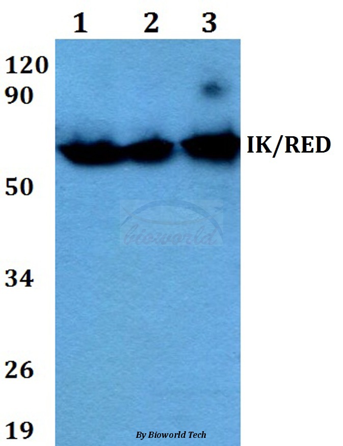 Western blot (WB) analysis of IK/RED (P555) pAb at 1:500 dilution Lane1:A549 whole cell lysate Lane2:sp2/0 whole cell lysate Lane3:PC12 whole cell lysate
