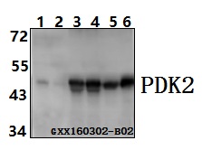 Western blot (WB) analysis of PDK2 (R291) pAb at 1:500 dilution Lane1:HEK293T whole cell lysate(40ug) Lane2:L02 whole cell lysate(40ug) Lane3:The brain tissue lysate of Mouse(40ug) Lane4:The brain tissue lysate of Rat(40ug) Lane5:The liver tissue lysate of Mouse(40ug) Lane6:The liver tissue lysate of Rat(40ug)