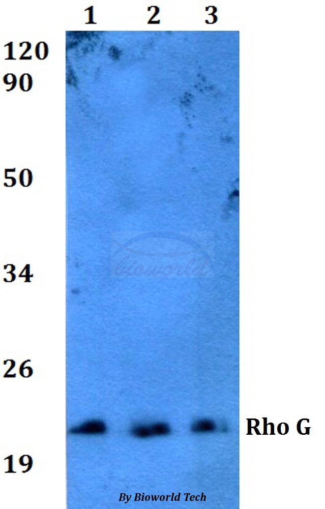 Western blot (WB) analysis of Rho G (Q132) pAb at 1:500 dilution Lane1:A549 whole cell lysate Lane2:sp2/0 whole cell lysate Lane3:PC12 whole cell lysate