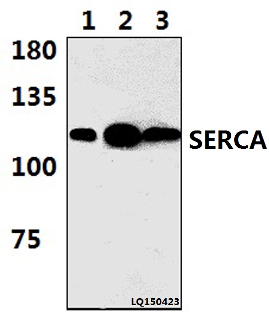 Western blot (WB) analysis of SERCA1 (D580) pAb at 1:1000 dilution Lane1:HEK293T whole cell lysate(37ug) Lane2:The Muscle tissue lysate of Rat(47ug) Lane3:The Muscle tissue lysate of Mouse(37ug)