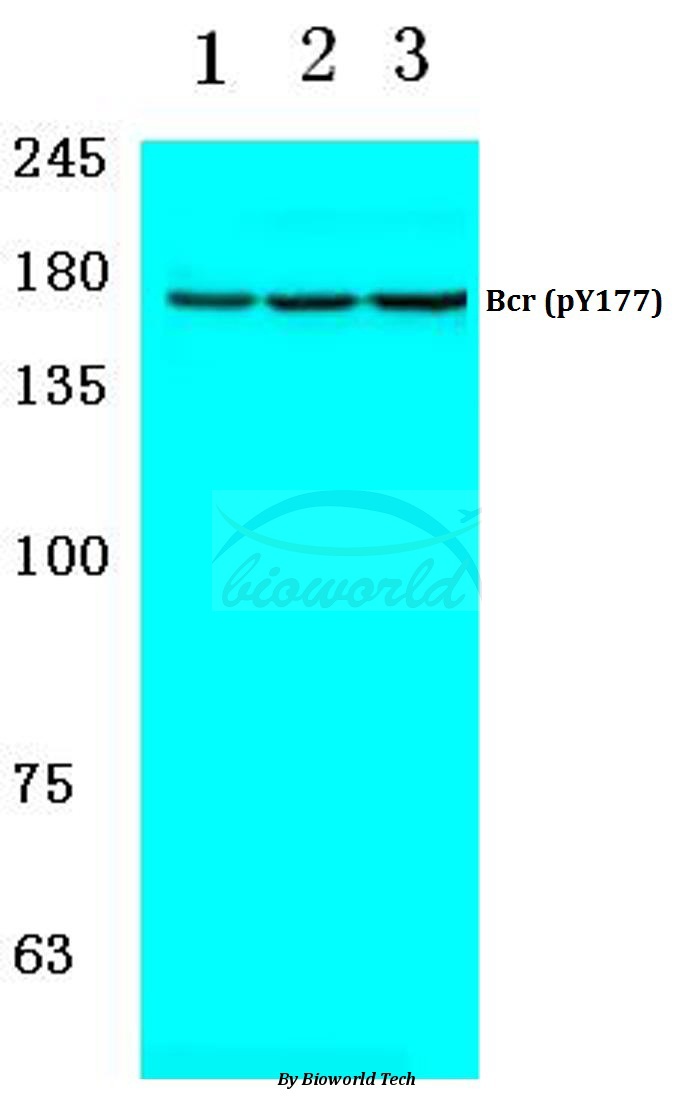 Western blot (WB) analysis of p-Bcr (Y177) pAb at 1:500 dilution Lane1:MCF-7 cell lysate treated with PMA Lane2:sp2/0 cell lysate treated with PMA Lane3:PC12 cell lysate treated with PMA